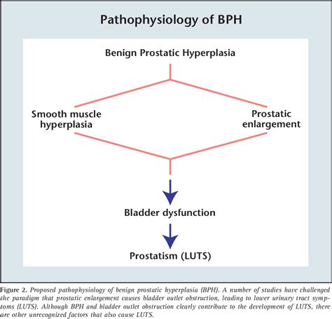 Pathophysiology Epidemiology And Natural History Of Benign Prostatic Hyperplasia Semantic
