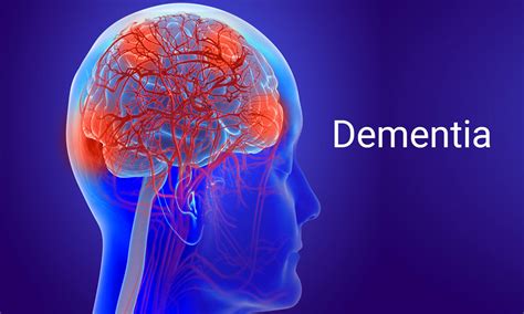 Aan Issues Updated Ethical Guidelines For Dementia Diagnosis And Care