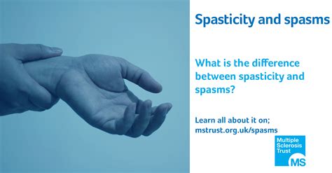 Spasticity Is A Symptom Of Multiple Sclerosis That Causes Your Muscles
