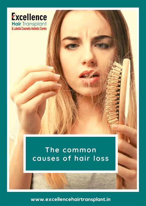Ppt The Common Causes Of Hair Loss Hair Loss Treatment Powerpoint