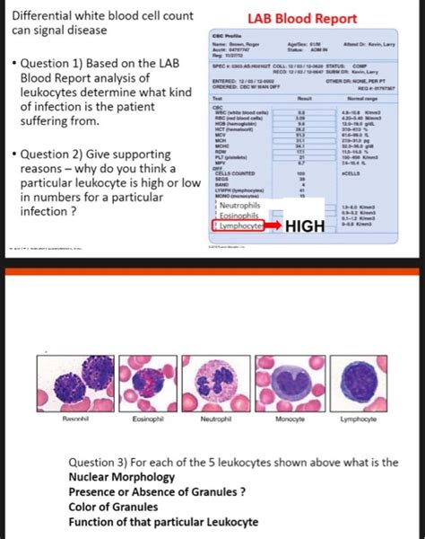 How Long Do Antibiotics Affect White Blood Cell Count