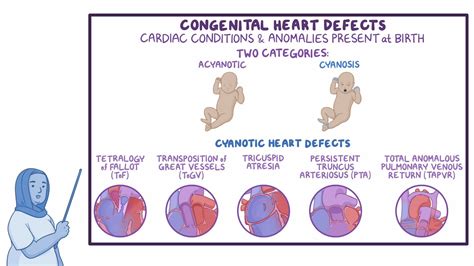 Congenital Heart Defects Cyanotic Nursing Osmosis Video Library