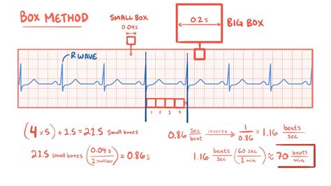 Ecg Rate And Rhythm Video Anatomy And Definition Osmosis