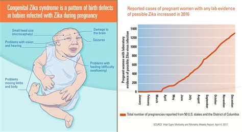 Zika In Us Pregnant Women About 1 In 10 With Confirmed Infection Had A