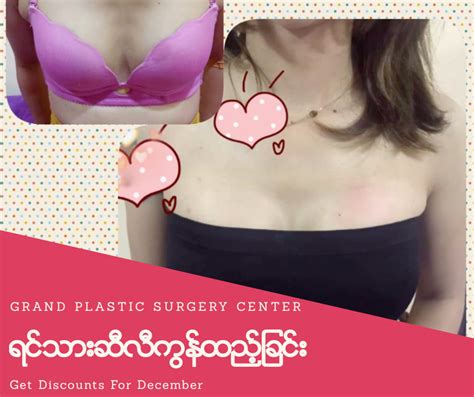 Grand Plastic Surgery Service Your Fitster Health And Beauty Myanmar