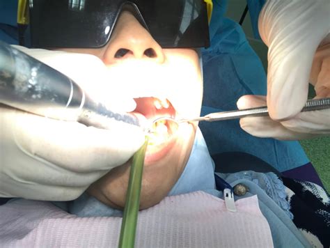 Jangan tunggu gigi sakit baru nak datang klinik gigi. Cara Untuk Mendapatkan Rawatan Diklinik Pergigian UiTM Sg ...