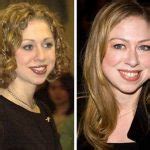 Plastic surgery procedures preformed on chelsea clinton Chelsea Clinton - Are speculations of Plastic Surgery true?
