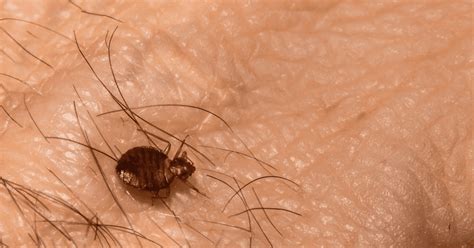Do Bed Bugs Bite Every Night And How Often Do They Bite