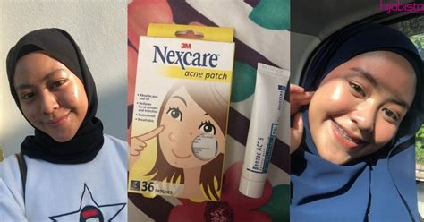 Dalam menangani permasalahan anak usia dini, saran dan nasihat untuk buah hati sangat diperlukan. Muka Breakout Sebab Stress Exam, Gadis Ini Temui Cara ...