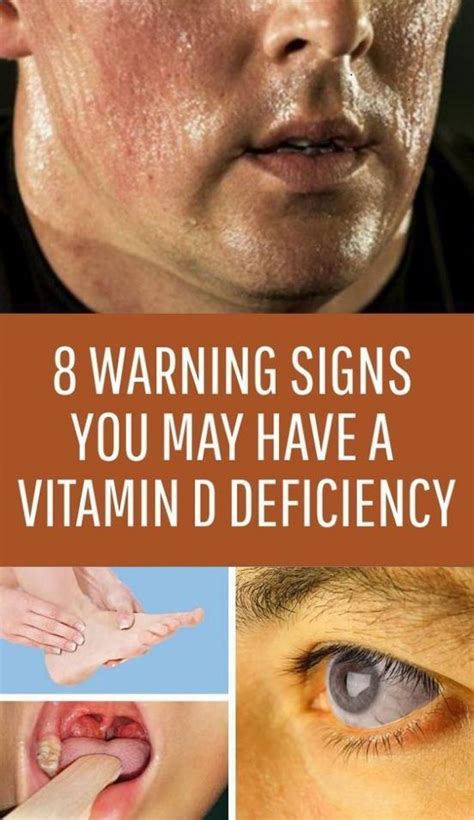 8 Signs That You May Have Deficiency In Vitamin D And How To Get More