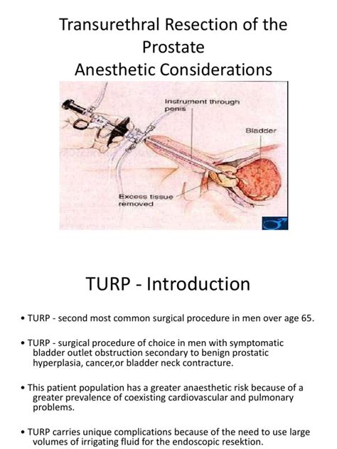 Turp Medical Specialties Clinical Medicine