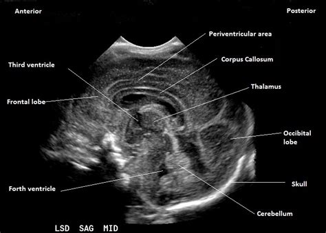 Sagittal View