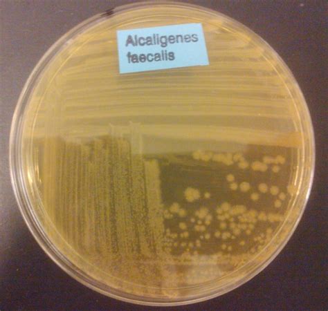 Alcaligenes Faecalis Plate 011 Flickr Photo Sharing