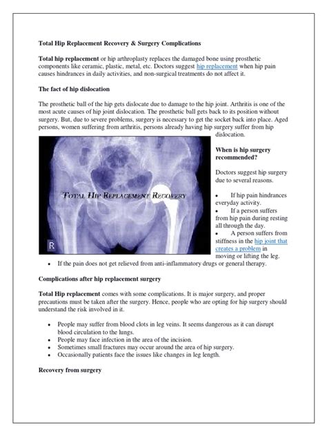 Total Hip Replacement Recovery And Surgery Complications Dr Vinil
