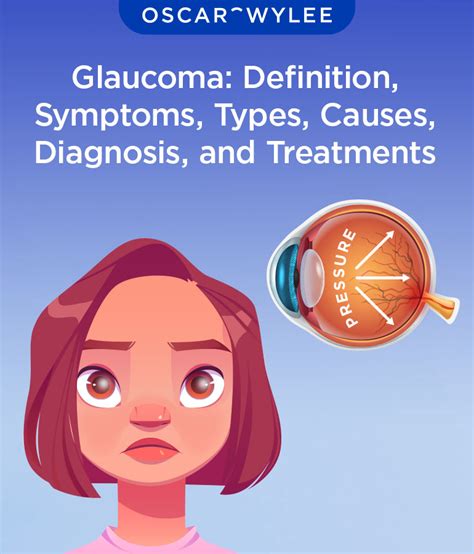 Glaucoma Definition Symptoms Types Causes Diagnosis And Treatments