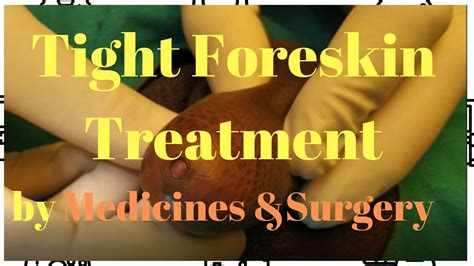 What Is Tight Foreskin Treatment With Circumcision Surgery Drkuber