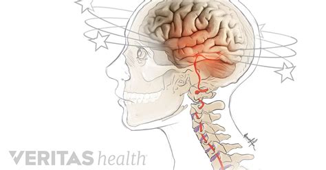 Lower Back Pain Nausea Headache Dizziness Headache