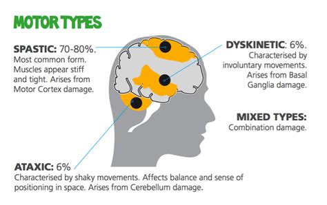 The Main Types Of Cerebral Palsy Cerebral Palsy Scotland