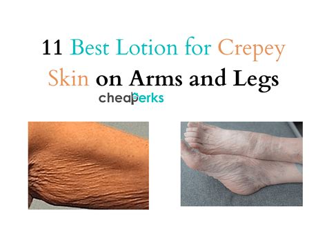 11 Best Lotion For Crepey Skin On Arms And Legs 2022 Guide