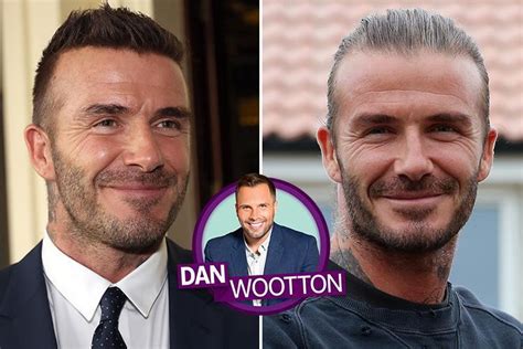 David Beckham Becomes One Of Growing Number To Have A Hair Transplant
