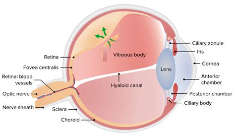 Retinal Detachment Concise Medical Knowledge