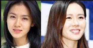 Son Ye Jin Plastic Surgery Before And After Pics Check Shocking