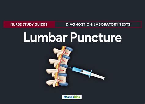 Lumbar Puncture Spinal Tap Lumbar Puncture Nursing Procedures Nurse