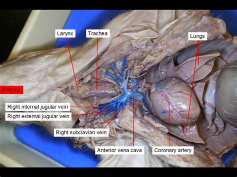 Blood vessel, a vessel in the human or animal body in which blood circulates. Anatomy Dissections: Dissection No. 4: The Fetal Pig Blood ...