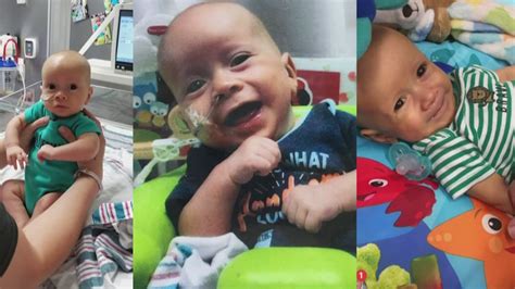 Baby Born With Hole In His Stomach Fighting For His Life