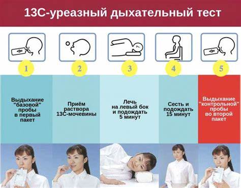Гастрит это пожизненная диета