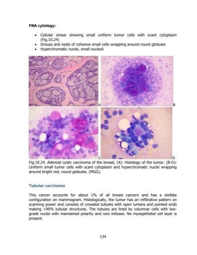 Fna Cytology • Cellula