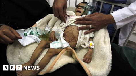Yemen Food Crisis Could Become Famine This Year Un Warns Bbc News