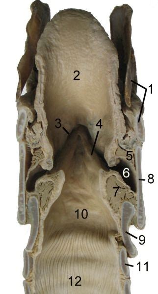 Larynx Wikidoc