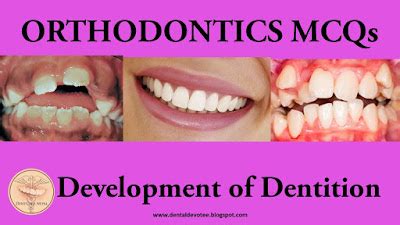 Dentosphere : World of Dentistry: MCQs on Development of Dentition