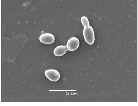 Candida Glabrata Yeast Under Electron Microscope The Figure Shows Two Download Scientific