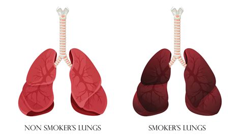 Illustration Of Normal Healthy Lungs And Lungs Smoker Concept Of Stop