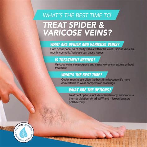 Do Laser Treatments For Spider Varicose Veins Hurt The Vein Company