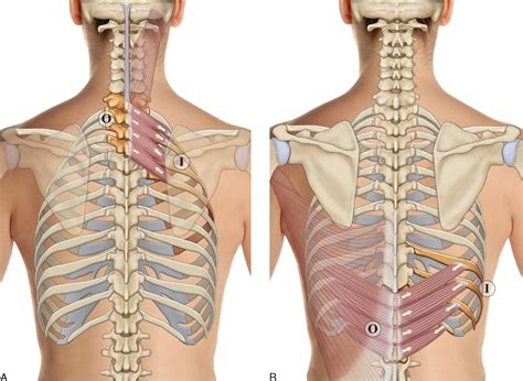 8 Muscles Of The Spine And Rib Cage Musculoskeletal Key
