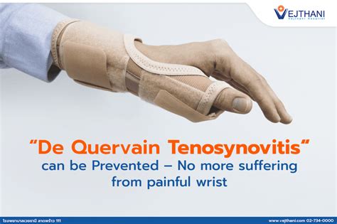 De Quervain Tenosynovitis Can Be Prevented No More Suffering From Painful Wrist Vejthani