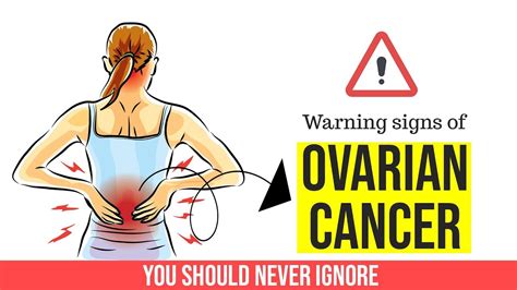 What Are The Colors For Ovarian Cancer Ovarian Cancer The Bedside