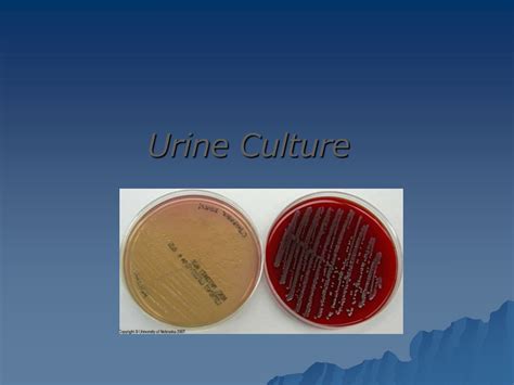 Ppt Urine Culture Powerpoint Presentation Free Download Id9205559