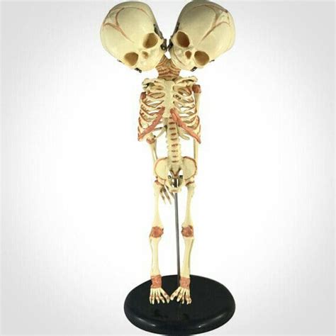2 Headed Fetal Skeleton Human Fetus Skeleton Conjoined Twins Skeleton