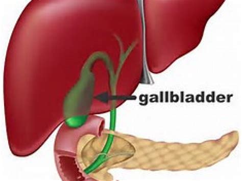 Are You At Risk Of Developing Gallbladder Disease Med Tech Industry In