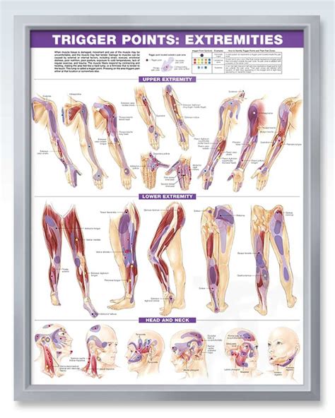 trigger points set exam room anatomy posters clinicalposters
