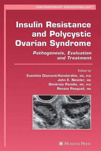Insulin Resistance And Polycystic Ovarian Syndrome Pathogenesis