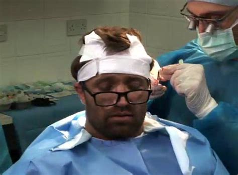 Michael Grays Hair Transplant Is Broadcast Live On The Internet Daily Mail Online