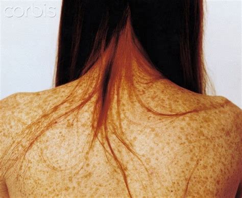 Freckled Back Of A Woman With Long Red Hair Women With Freckles