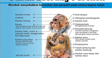 Ukm Granat Dpr Unwidha Dampak Rokok Bagi Organ Tubuh