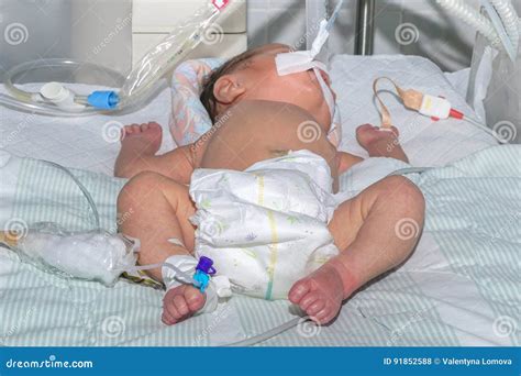 Newborn Baby On Breathing Machine With Pulse Oximeter Sensor And