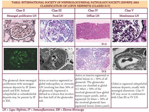 Classification Of Lupus Nephritis An Update Lupus Nephritis Lupus